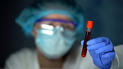 三甲医院可以做DNA检测吗?