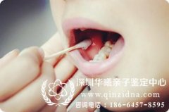 不去鉴定机构怎么在家采集亲子鉴定样本