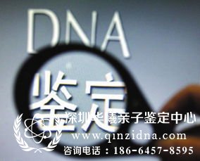 <a data-cke-saved-href=http://www.qinzidna.com/charge/ href=http://www.qinzidna.com/charge/ target=_blank >亲子鉴定多少钱</a>