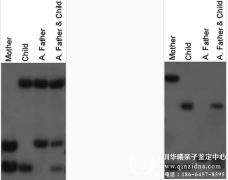 DNA亲子鉴定原理程序是什么,有什么依据吗