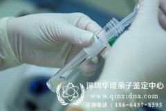 深圳什么地方可以做亲子鉴定