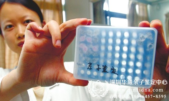 亲子鉴定准确率是多少?要多少钱?
