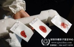 做亲子鉴定需要对方什么物品，什么物品都可以吗