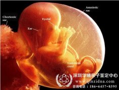 孕妇如何抽绒毛做胎儿亲子鉴定