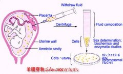 做胎儿亲子鉴定中羊水穿刺收费多少钱