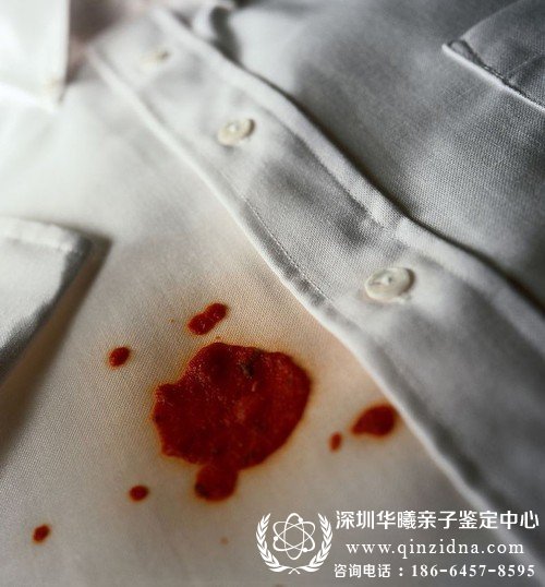 血斑样本DNA鉴定