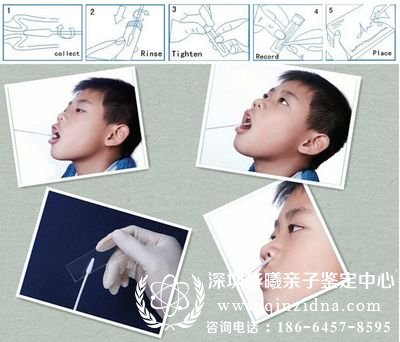 口腔拭子亲子鉴定