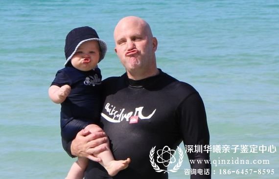 怎么确认小孩是不是自己亲生的
