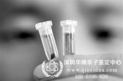 可以采集老公的精液在深圳做亲子鉴定吗