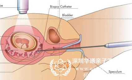 羊水亲子鉴定示意图