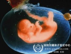 怀孕两个月担心小孩不是老公的,深圳哪里可以做羊水鉴定