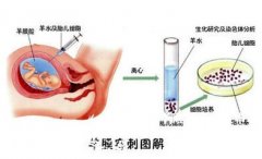 深圳哪里可以做羊水穿刺比较安全，多少时间可以做