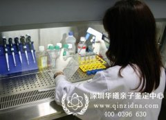 精斑可以做亲子鉴定吗,如何正确采集精斑样本