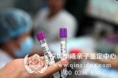 血液做DNA亲子鉴定的费用是多少