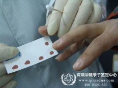 司法亲子鉴定怎么做，司法亲子鉴定的流程是怎样的