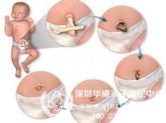 婴儿脐带能做亲子鉴定吗？