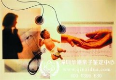 怎么做亲子鉴定,需要什么手续？