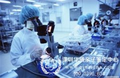 怎么做亲子鉴定最简单方便