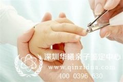 指甲是否含有DNA，可作为亲子鉴定样本吗？