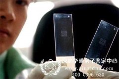 妻子怀疑丈夫出轨，对可疑斑迹进行DNA鉴定