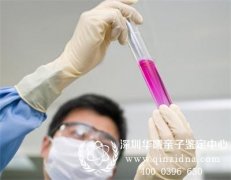 DNA亲子鉴定中常用的取样方式