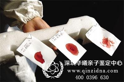 亲子鉴定的样本如何保存