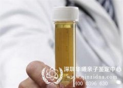 三岁以下的小孩可以用尿液排泄物做亲子鉴定吗
