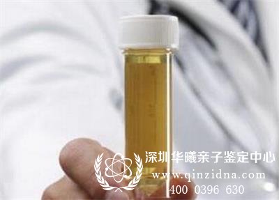 尿液可以做亲子鉴定吗