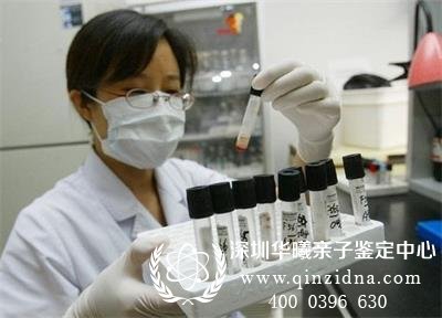 做亲子鉴定需要男人的什么