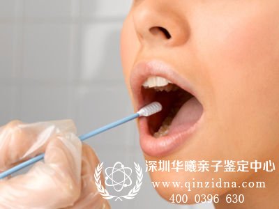 口水可以做亲子鉴定的样本吗