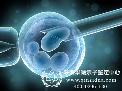 人工受精生下的儿子非亲生,男子起诉离婚
