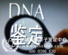 DNA鉴定都有哪些内容，动物也能做亲子鉴定吗