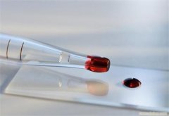 亲子鉴定用血液时一般需