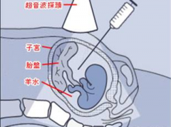 哪里做羊水亲子鉴定比较好