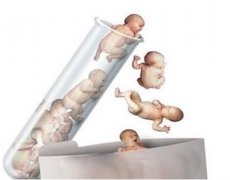 媳妇伙同老公借精生子，孩子出生后婆婆偷做亲子鉴定
