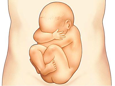 做胎儿亲子鉴定能分辨男女吗