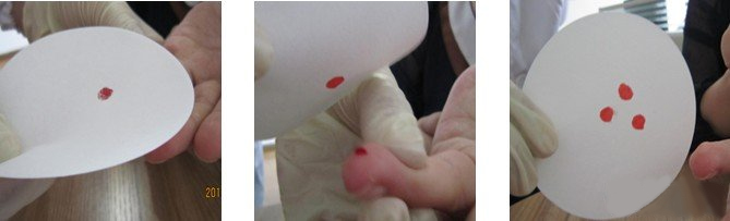 亲子鉴定血痕样本