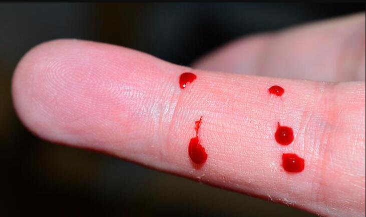 血痕采样 血痕采样