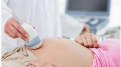 什么医院能做孕期无创亲子鉴定