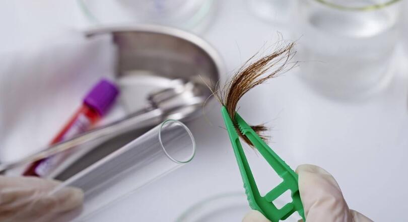 头发做亲子鉴定需注意什么