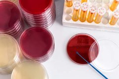 做DNA亲子鉴定的价格