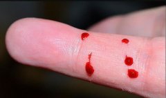 做亲子鉴定怎么偷偷做