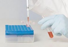 亲子鉴定中心哪里专业