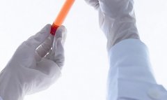 亲子鉴定在哪家正规医院可以做